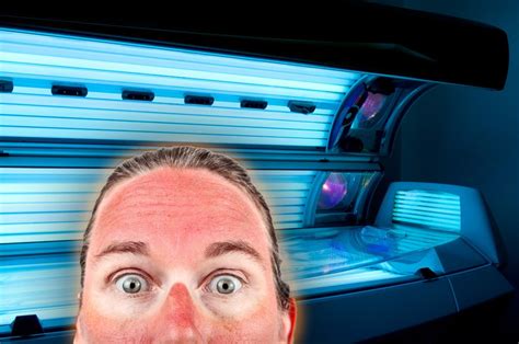 tanning bed burn vs sunburn.